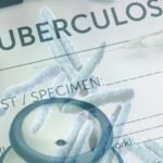 Tuberculosis outbreak reported in Kansas