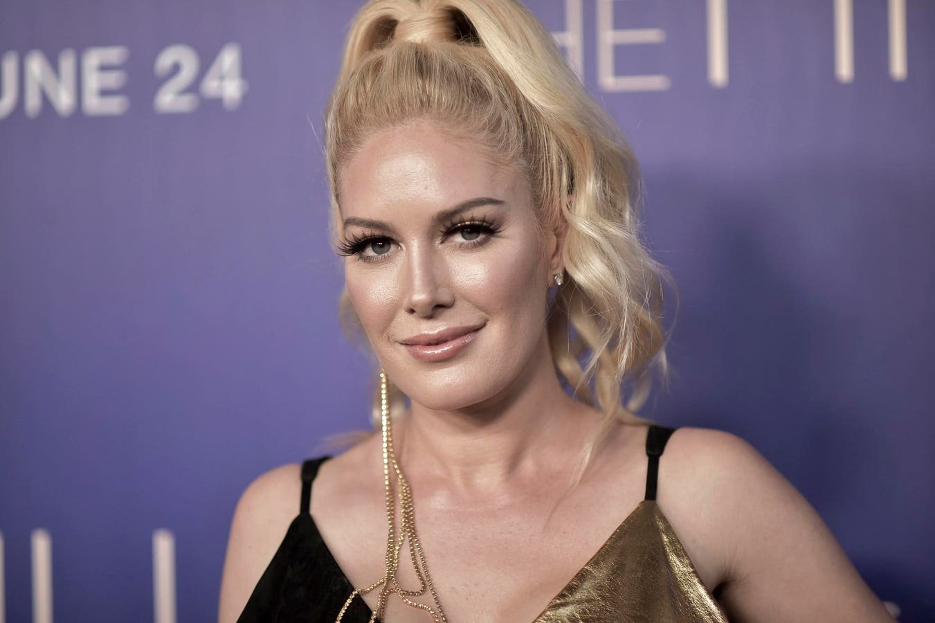 Heidi Montag Reportedly Sues City Of Los Angeles After Home Is Destroyed By Palisades Fire