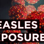 Health officials issue warning about possible measles exposure at CHOP ER, South Philadelphia Health & Literacy Center