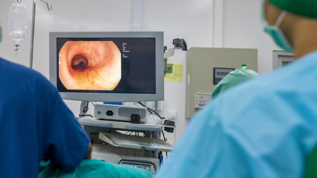 Experts weigh AI-assisted colonoscopy benefits