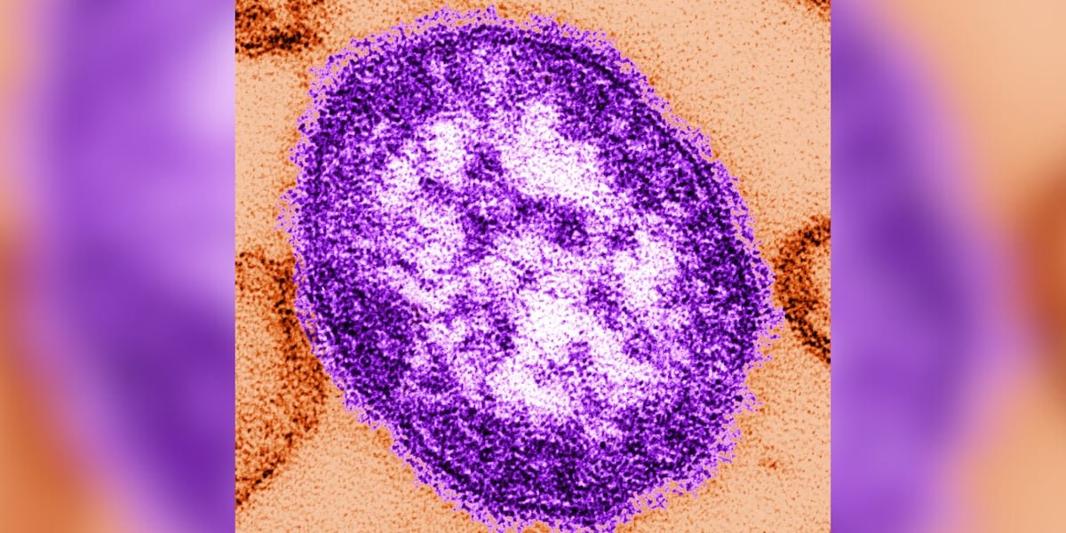 Health officials warn of possible measles exposure in W.Va.